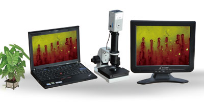 TR8000 Microcirculation Analyzer (laptop type)