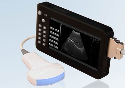 KR-1088E palm size ultrasound scanner