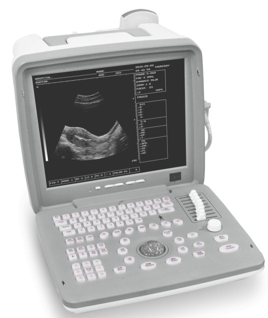 KR-2088V Full Digital Portable Ultrasound Scanner