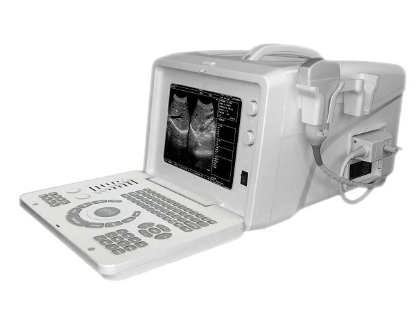 KR-1288V Portable Ultrasound Scanner